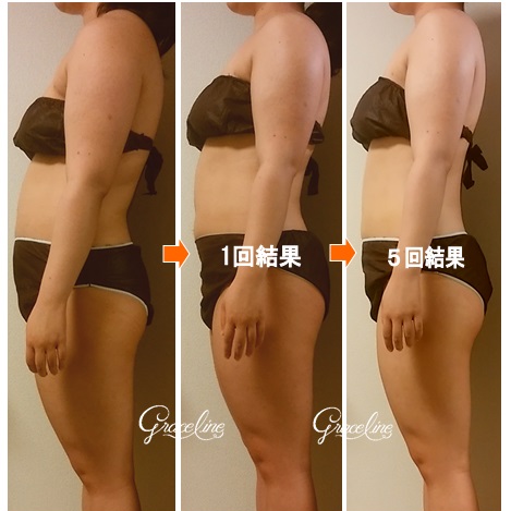 筋膜リリース施術5回効果　スピリチュアル整体×筋膜リリース　Graceline　グレイスライン