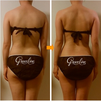 筋膜リリース施術1回効果 スピリチュアル整体×筋膜リリース　Graceline グレイスライン