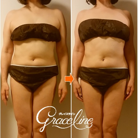 筋膜リリース施術1回効果　スピリチュアル整体×筋膜リリース　Graceline　グレイスライン