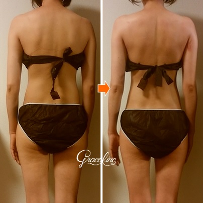 筋膜リリース施術1回効果　スピリチュアル整体×筋膜リリース　Graceline　グレイスライン