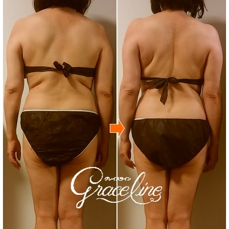 筋膜リリース施術1回効果　スピリチュアル整体×筋膜リリース　Graceline　グレイスライン